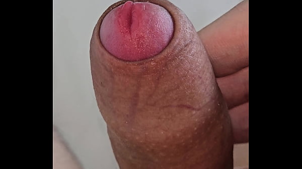 包皮翻開的瞬間 3